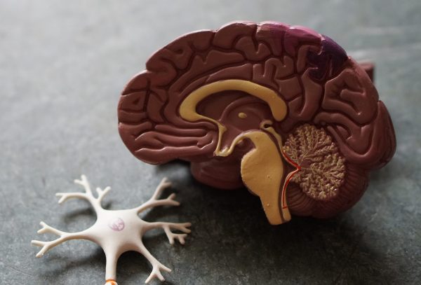 model of a brain